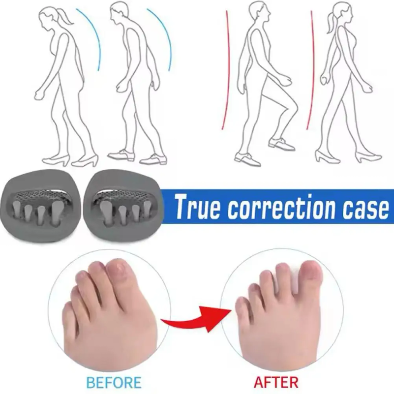 Leg Correction Slippers Scient - Home Improvement Man review and price